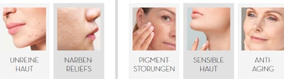 Wo Microneedling